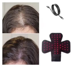 Dispozitiv Laser cu Infrarosu pentru Regenerarea si Prevenirea Caderii Parului